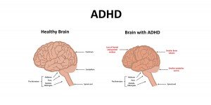 Elite Home Tutoring 5 Simple Strategies To Help Your ADHD Child Achieve ...